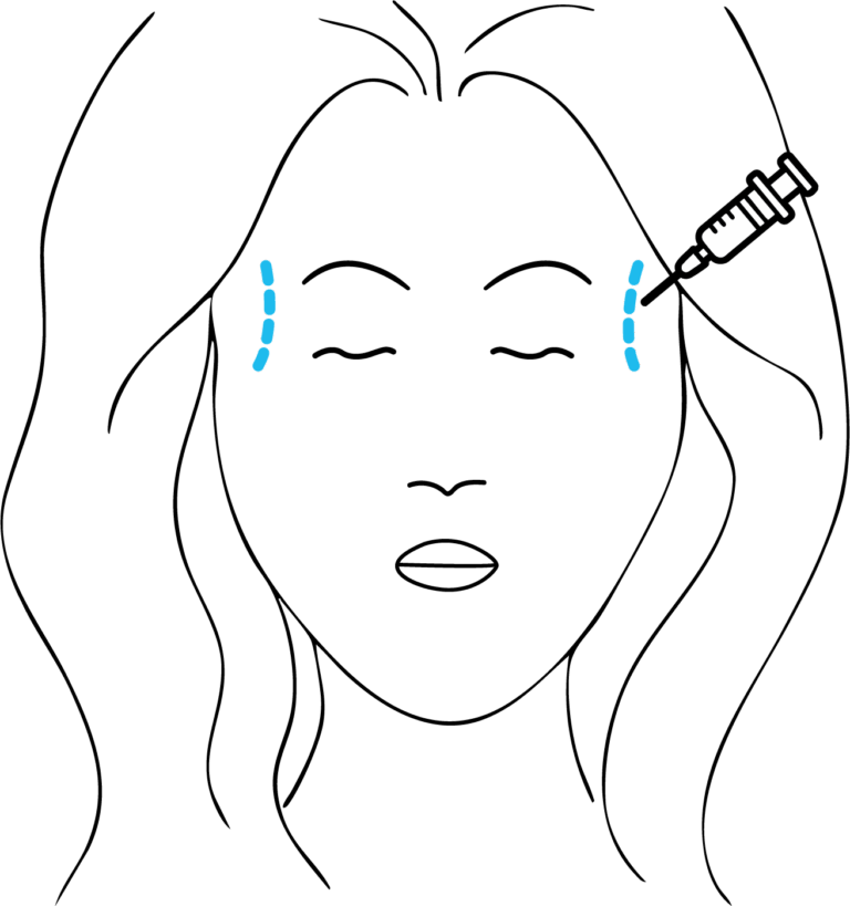Afbeelding van behandeling Ingevallen slapen