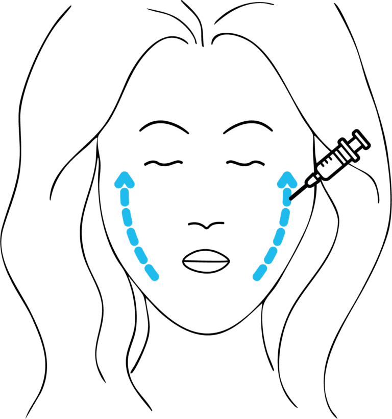 Afbeelding van behandeling Liquid facelift
