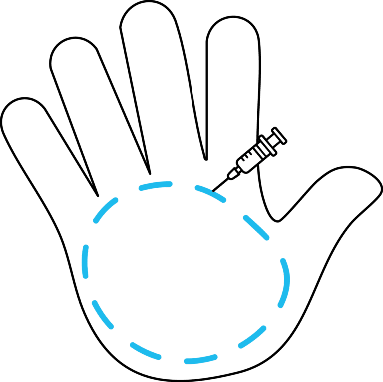 Afbeelding van behandeling Handen