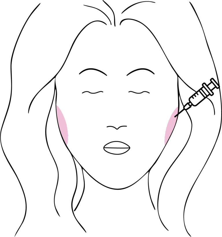 Afbeelding van behandeling Kaakklemmen